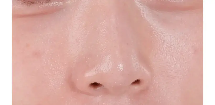 [모공전용딥클렌징] 메디필 레드 락토 콜라겐 클렌징 오일 2.0 200ml 상세페이지 18
